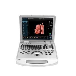 color doppler ultrasound machine