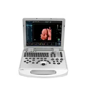 color doppler ultrasound machine