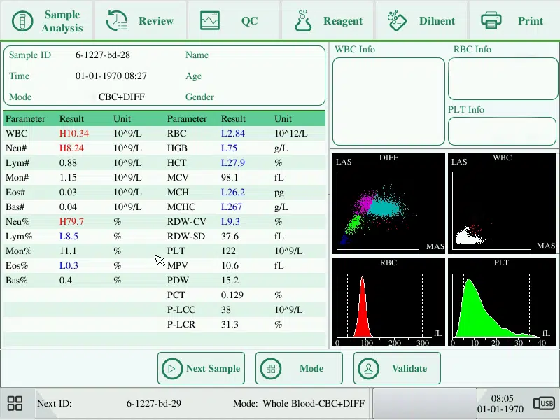 5 Part Hematology Analyzer parameters display