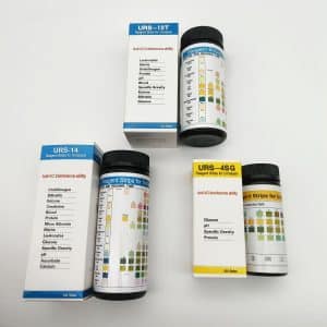 Urine Analysis Test