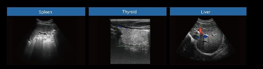 OBGYN Recommended Color Doppler Ultrasound Machine-MS-U50 7 Color doppler ultrasound images2-MS-U50