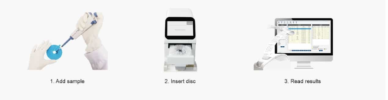 On-site Blood Chemistry Analyzer MS-4 5 Operation steps for MS-4 Blood chemistry analyzer