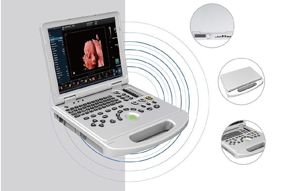 OBGYN Recommended Color Doppler Ultrasound Machine-MS-U50 5 color doppler ultrasound machine-MS-U50